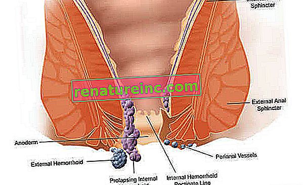 Diagram med indvendige og udvendige hæmorroider
